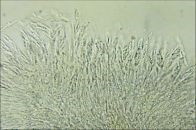 Acanthonitschkea tristis