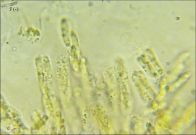 Acanthonitschkea tristis