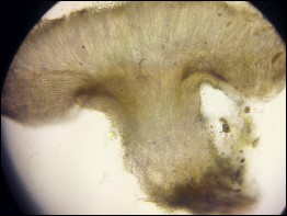 Allophylaria macrospora