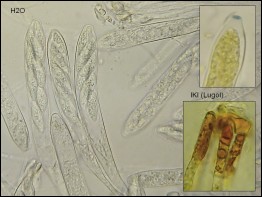 Allophylaria macrospora