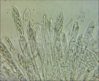 Allophylaria macrospora