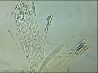 Allophylaria macrospora