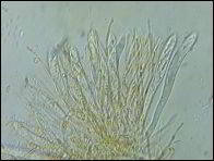 Arachnopeziza trabinelloides