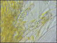 Arachnopeziza trabinelloides