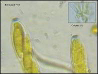 Arachnopeziza trabinelloides