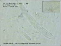 Arachnopeziza trabinelloides