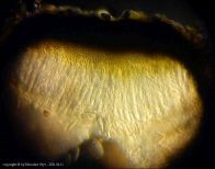 Dothiora sphaeroides