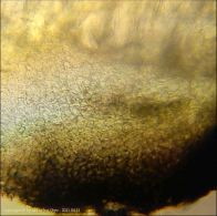 Dothiora sphaeroides