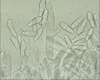 Dothiora sphaeroides