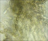 Dothiora sphaeroides