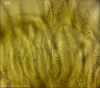 Dothiora sphaeroides