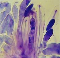 Dothiora sphaeroides