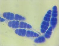 Dothiora sphaeroides