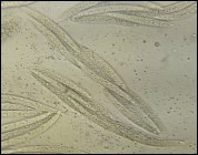 Pseudovalsa longipes