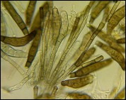 Pseudovalsa longipes