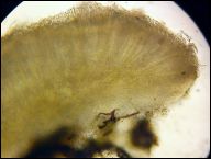 Strossmayeria basitricha