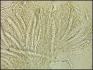 Strossmayeria basitricha