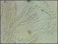 Strossmayeria basitricha