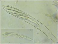 Strossmayeria basitricha