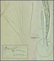 Strossmayeria basitricha