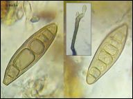 Strossmayeria basitricha