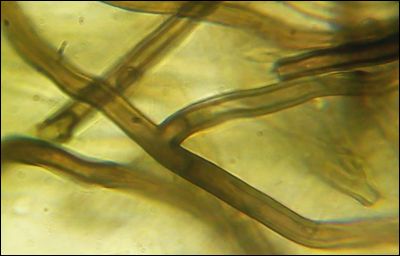Pseudotomentella tristis