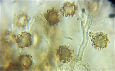 Pseudotomentella tristis