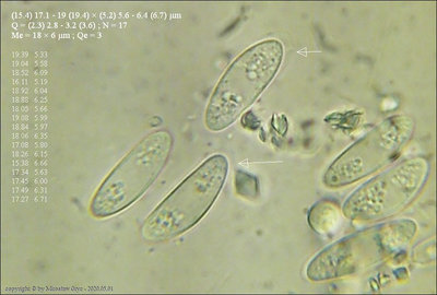 Rutstroemia henningsiana