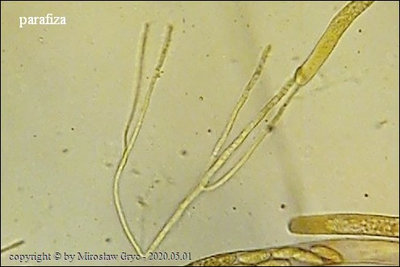 Rutstroemia henningsiana