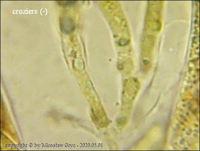 Rutstroemia henningsiana