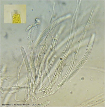Rutstroemia henningsiana