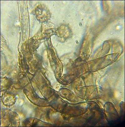 Thelephora allobadia