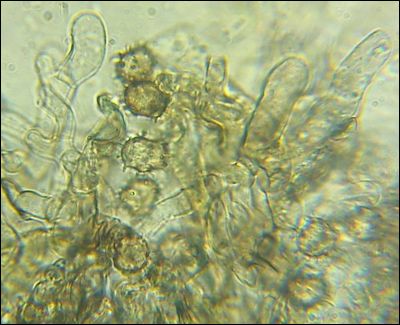 Thelephora allobadia