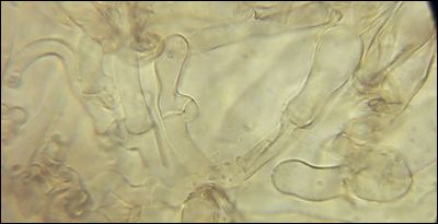 Thelephora extendens