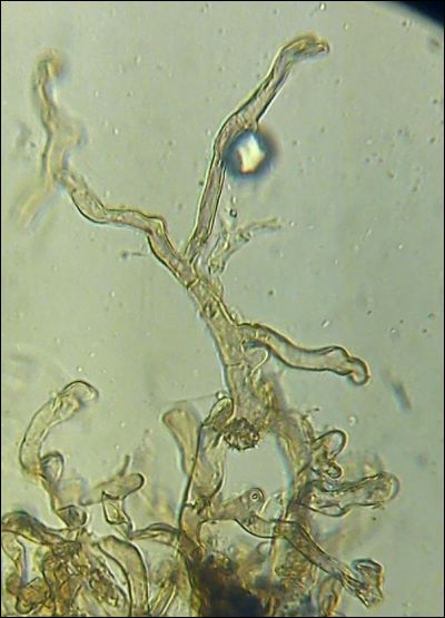 Thelephora lapida