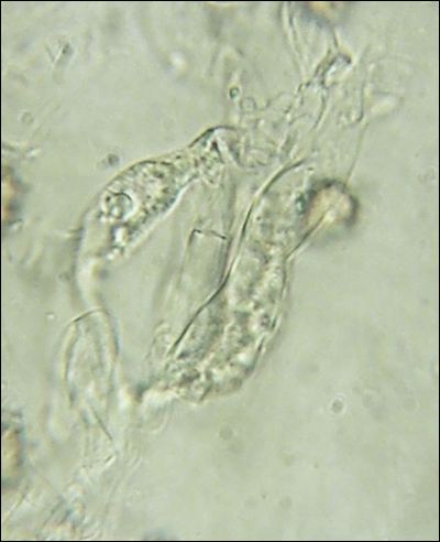 Thelephora lilacinogrisea