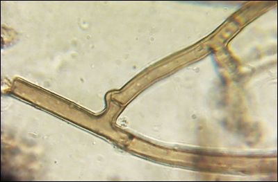 Thelephora lilacinogrisea