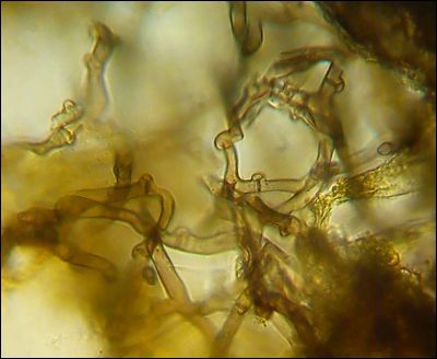 Tomentella sp. 2026.09.01