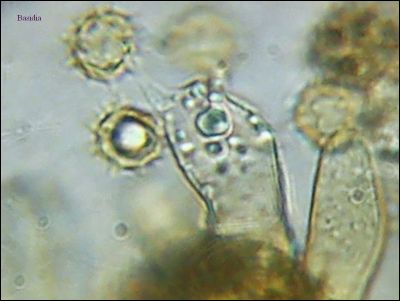 Tomentella sp. 2026.09.01