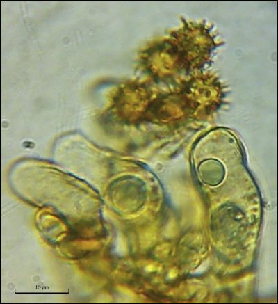 Tomentella sp. 2026.09.01