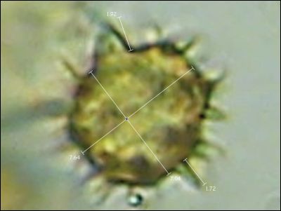 Tomentella sp. 2026.09.01