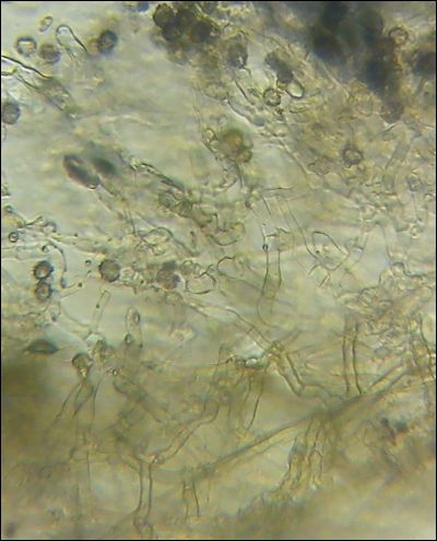 Tomentella galzinii