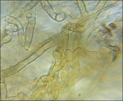 Tomentella galzinii