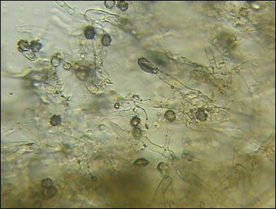 Tomentella galzinii