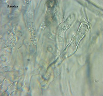 Tomentella galzinii