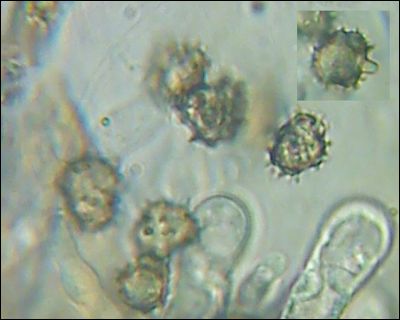 Tomentella galzinii