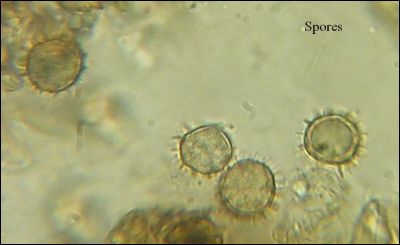 Tomentella stuposa