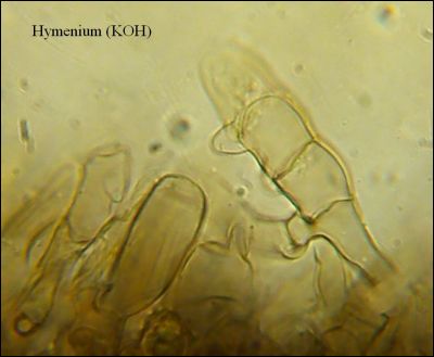 Tomentella stuposa