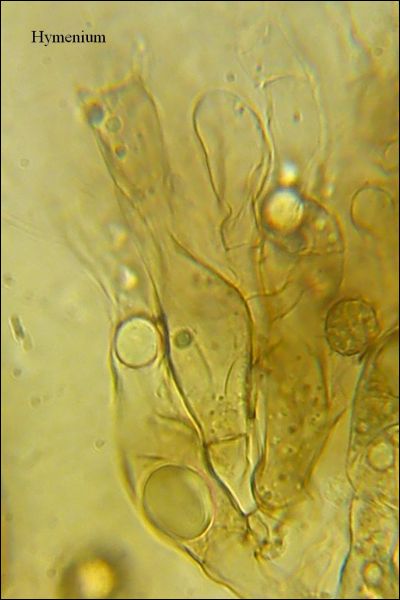 Tomentella stuposa