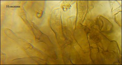 Tomentella stuposa